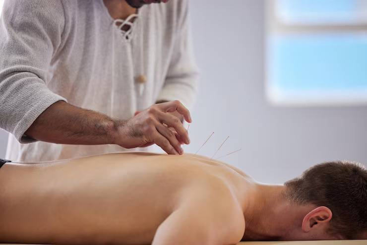 Embark on a Holistic Healing Journey Acupuncture Diploma Program in Canada