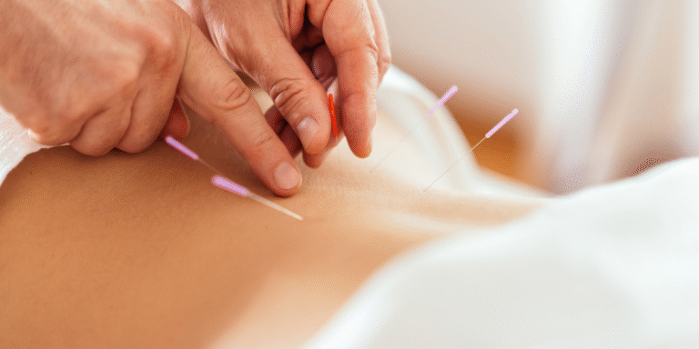 What Does a Registered Acupuncturist Do
