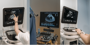 What Subjects Do You Study in a Diagnostic Medical Sonography Program